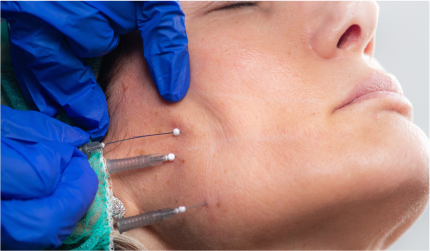Neurotoxin treatment being administered