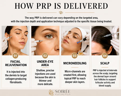 PRP Steps prp-steps
