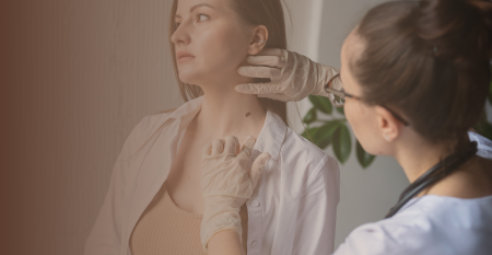 DPN Skin Tag Mole Removal
