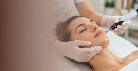 Microneedling